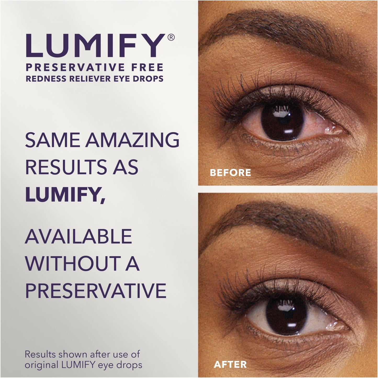 Lumify Redness Relief Eye Drops, Whiter & Brighter Looking Eyes, 0.25 oz | Works in 1 minute, lasts up to 8 hours, For Whiter & Brighter Looking Eyes, 1 bottle
