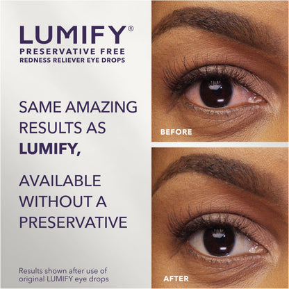 Lumify Redness Relief Eye Drops, Whiter & Brighter Looking Eyes, 0.25 oz | Works in 1 minute, lasts up to 8 hours, For Whiter & Brighter Looking Eyes, 1 bottle