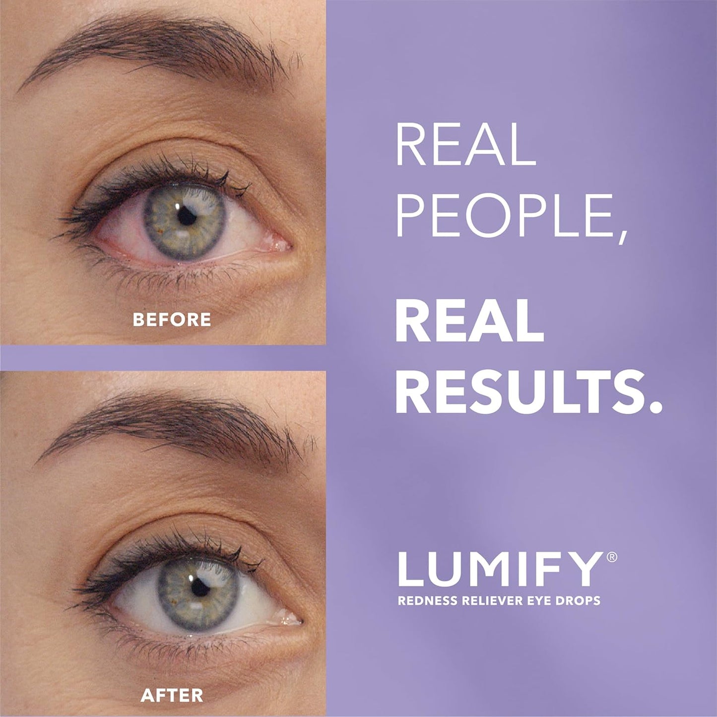 Lumify Redness Relief Eye Drops, Whiter & Brighter Looking Eyes, 0.25 oz | Works in 1 minute, lasts up to 8 hours, For Whiter & Brighter Looking Eyes, 1 bottle