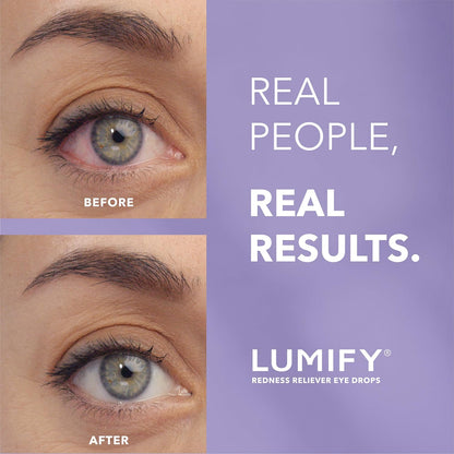 Lumify Redness Relief Eye Drops, Whiter & Brighter Looking Eyes, 0.25 oz | Works in 1 minute, lasts up to 8 hours, For Whiter & Brighter Looking Eyes, 1 bottle